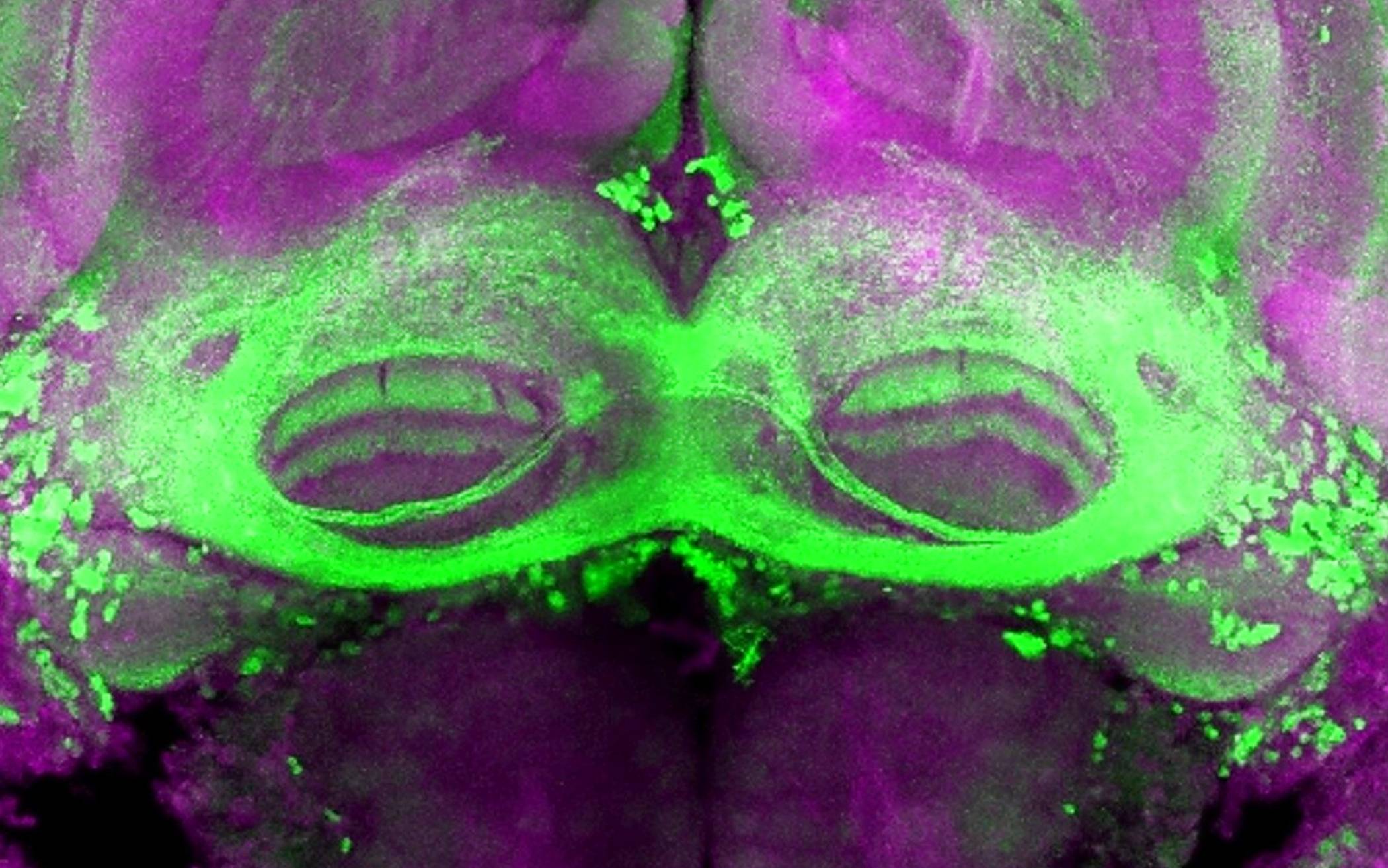  Mikroskop-Blick ins Drohnengehirn (violett): grün markiert sind die Neuronen, die das Verhalten bei der Futteraufnahme der Tiere steuern. 