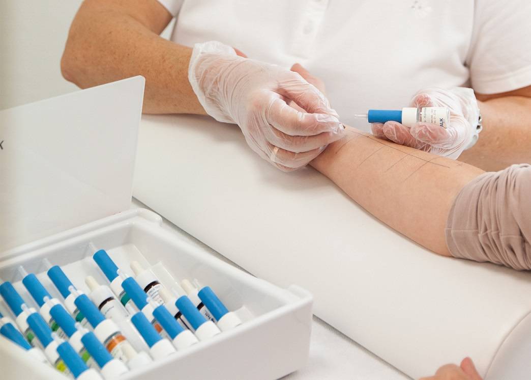 Allergien, Unverträglichkeiten &amp; Co — wieso gibt es sie und was kann man tun?